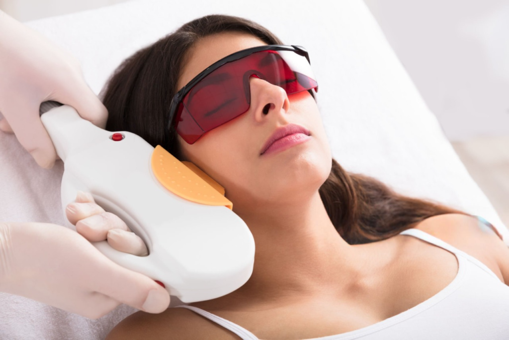 Laser facial hair removal for women with PCOS