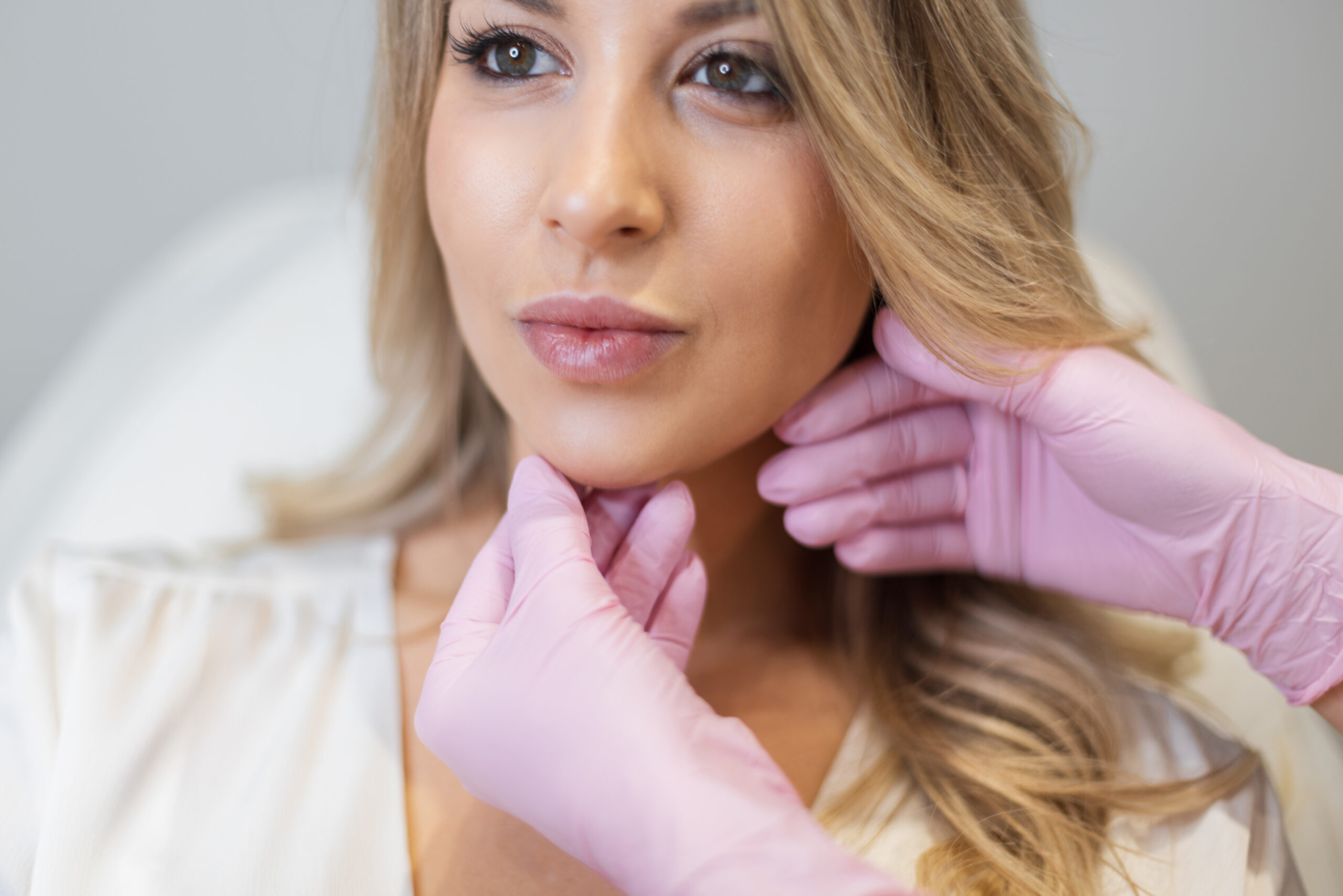 Chemical Peels Pembroke Pines